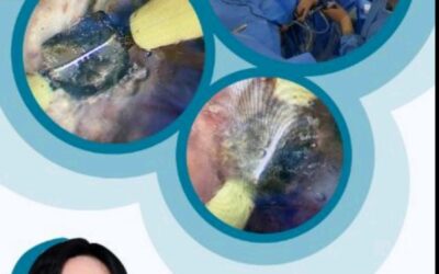 Events 8 Beyond TURP: Rediscovering the World of Enucleation