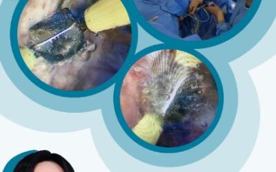 Events 2 VMMC 12th Post Graduate course: Beyond TURP Rediscovering the world of Enucleation